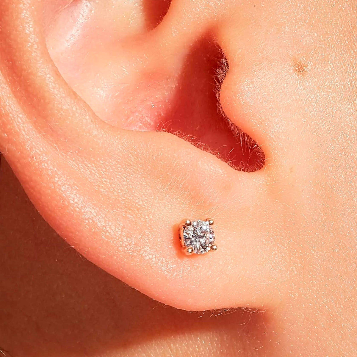 Topos Supreme Diamonds